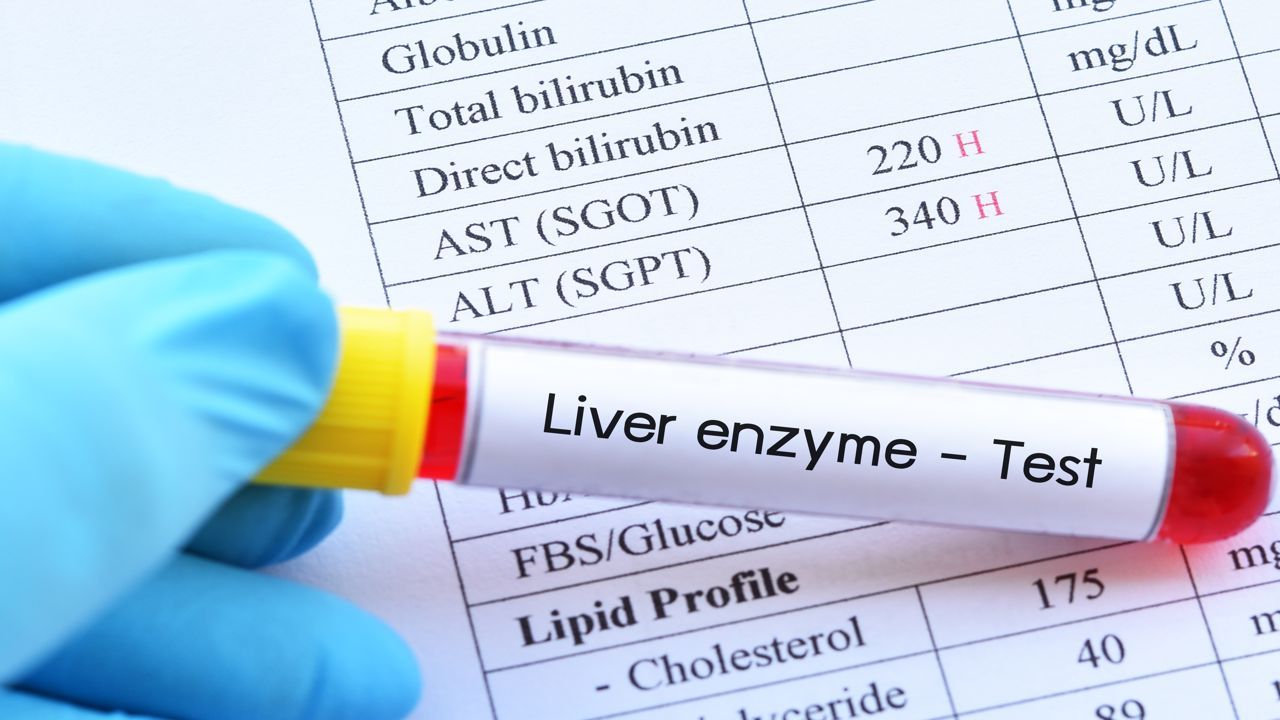 Abnormal Liver Enzyme
