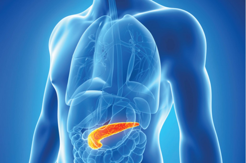 Obesity Can Lead to an Attack of Pancreatitis