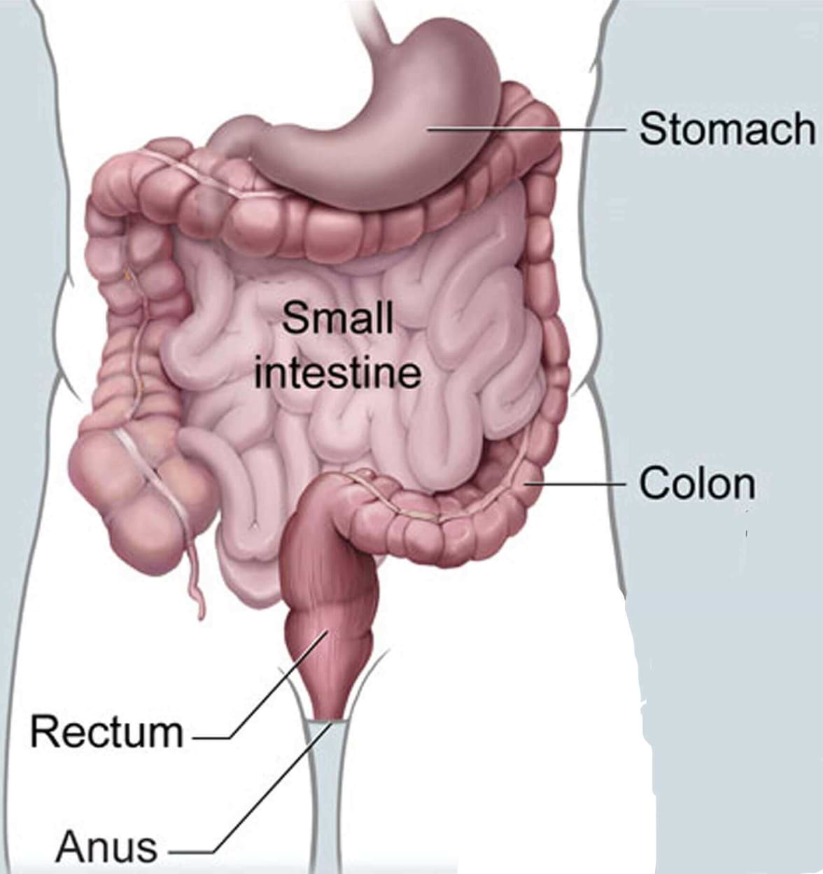 colon rectum cancer risk factors