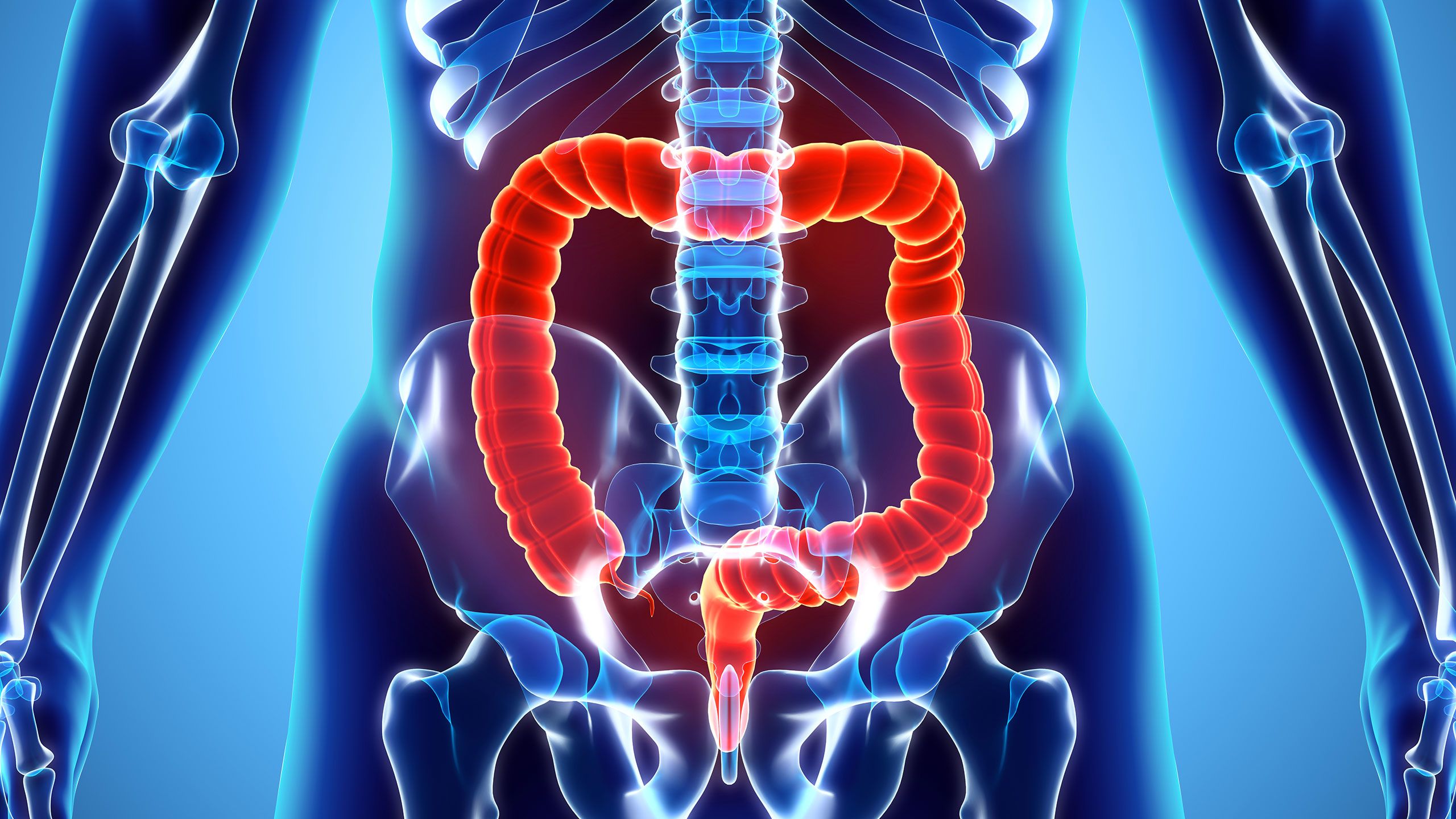colon rectum cancer life expectancy and prognosis