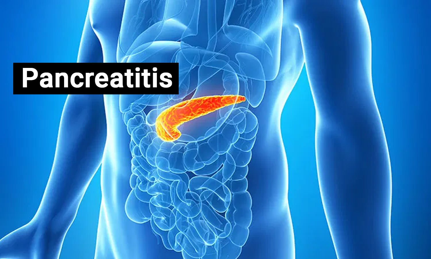 Pancreatitis- Acute and Chronic